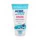 Dermacol AcneClear Antibacterial Gel za čišćenje lica za žene 150 ml